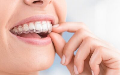 Brackets vs. Invisalign: ¿cuál es la mejor opción para tu caso?